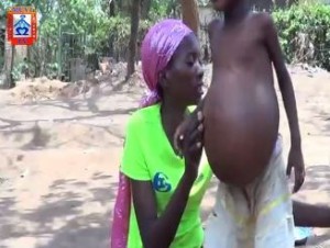 Zambia: Four Year Old Livingstone Girl Struggling With Bulging Stomach [VIDEO]